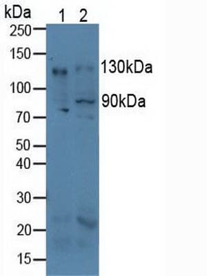 ITGAV/Integrin Alpha V/CD51 Antibody (aa71-322)