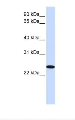 ZDHHC19 Antibody (aa201-250)
