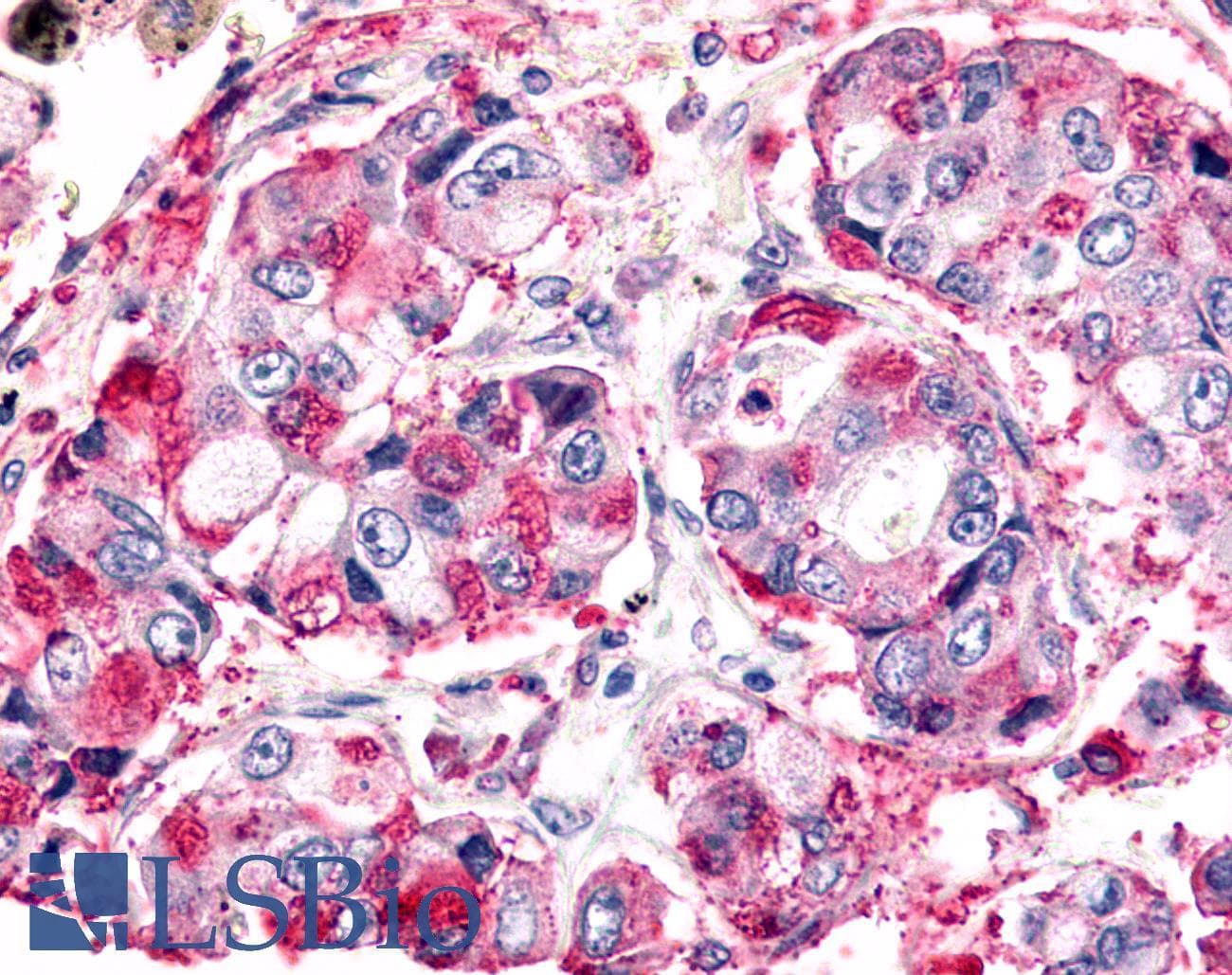 PathPlus™ Polyclonal Rabbit anti-Human ADGRL4 / ELTD1 Antibody (C-Terminus, IHC)