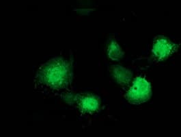 MAPRE2 / EB2 Antibody (clone OTI1D10)