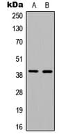 Polyclonal Rabbit anti-Human ATXN7L3 Antibody (Internal, WB)