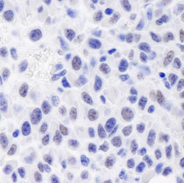 Polyclonal Rabbit anti-Human GTF2I / TFII I Antibody (aa950-C-term, IHC, IF)