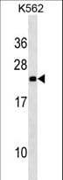 NOP16 Antibody (aa129-158)