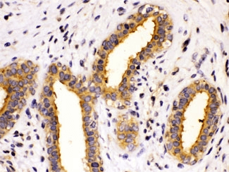 CCT8 Antibody