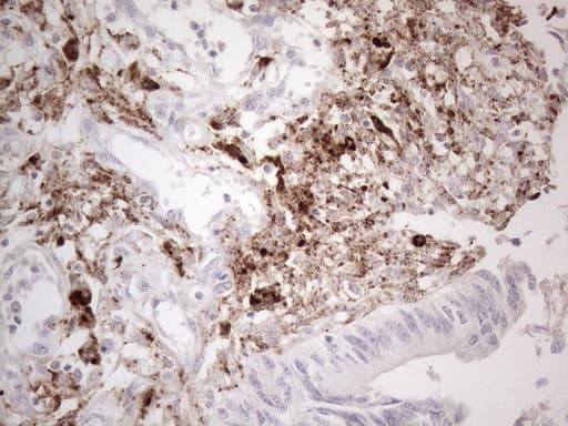 GPNMB / Osteoactivin Antibody (clone OTI2F9)