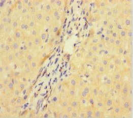 VPRBP Antibody