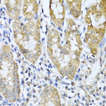 Polyclonal Rabbit anti-Human ASIP Antibody (IHC, IF)