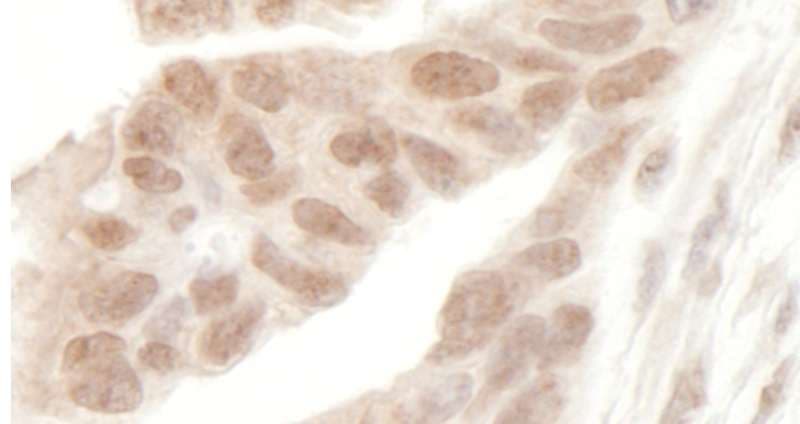 MLLT3 / AF9 Antibody (aa250-300)
