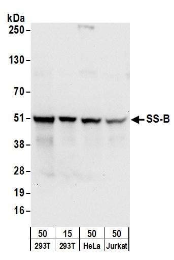 IHC-plus™ RPL26 / Ribosomal Protein L26 Antibody (aa95-145)