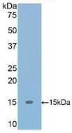 Human TGFB1 / TGF Beta 1 Protein (Recombinant His, N-Terminal)