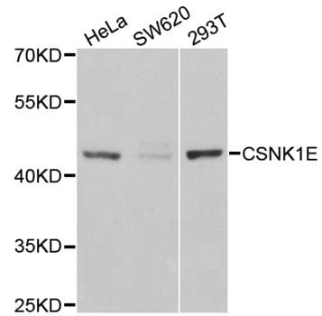 CSNK1E / CK1 Epsilon Antibody