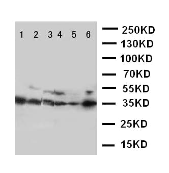Polyclonal Rabbit anti-Human AQP4 / Aquaporin 4 Antibody (aa258-274, IHC, WB)