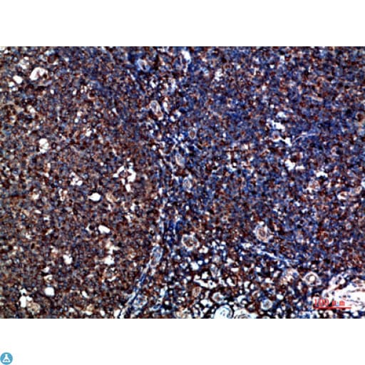 CYFIP2 / PIR121 Antibody