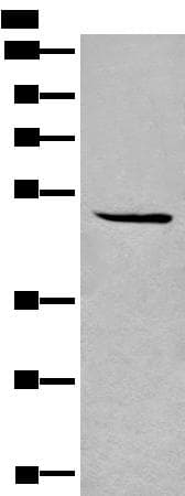 SPOCK3 Antibody