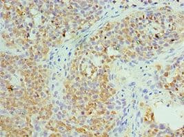 CCT6A Antibody (aa80-250)