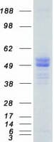 Human HTRA1 Protein (Recombinant Myc-DDK (Flag))