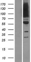 OSBPL9 Protein (Over-Expression Lysate Myc-DDK (Flag))