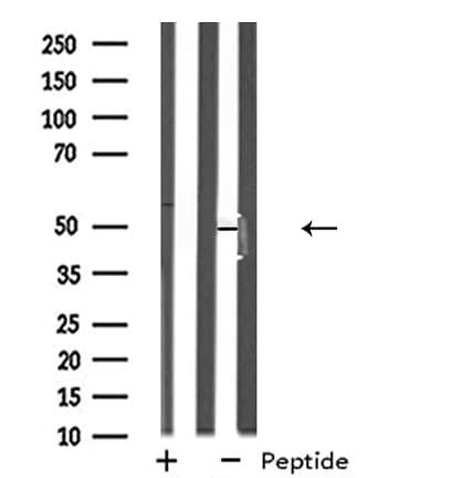 Polyclonal Rabbit anti-Human NPY5R Antibody (IHC, IF, WB)