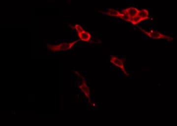 B4GALT1 Antibody