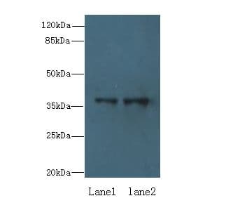 Polyclonal Rabbit anti-Human RPRD1B Antibody (IHC, WB)