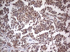 Monoclonal Mouse anti-Human PIK3CA / PI3K Alpha Antibody (clone OTI8D6, aa303-631, IHC)