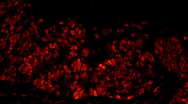 DFFA / ICAD / DFF45 Antibody (aa271-331)
