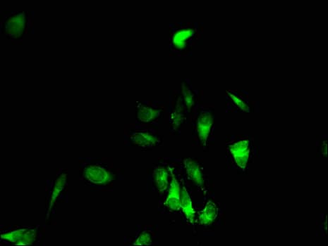 EPHB6 / EPH Receptor B6 Antibody