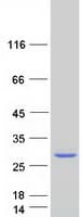 Human MAGEA5 Protein (Recombinant Myc-DDK (Flag))