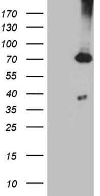 PGM2L1 Antibody (clone OTI1C2)
