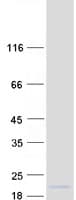 Human HOPX / HOP Protein (Recombinant Myc-DDK (Flag))