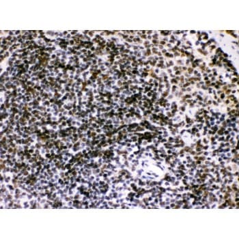 BIK Antibody (aa1-123)