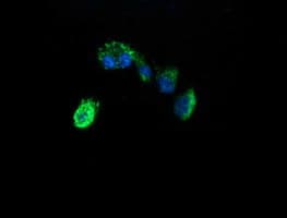 ACAA2 Antibody (clone OTI2H2)