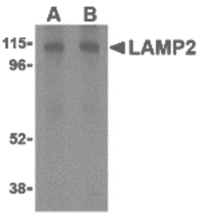 IHC-plus™ LAMP2 / CD107b Antibody