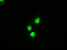 Monoclonal Mouse anti-Human MAP2K4 / MKK4 Antibody (clone OTI8A8, IHC, IF, WB)