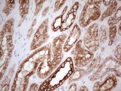ABCB1 / MDR1 / P Glycoprotein Antibody (aa995-1280, clone OTI1A7, Carrier-free)