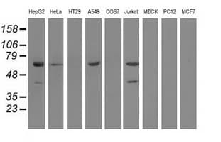 EPHX2 / Epoxide Hydrolase 2 Antibody (clone OTI1A6, Carrier-free)