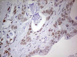 PRX-1 / PRRX1 Antibody (clone OTI1C2)