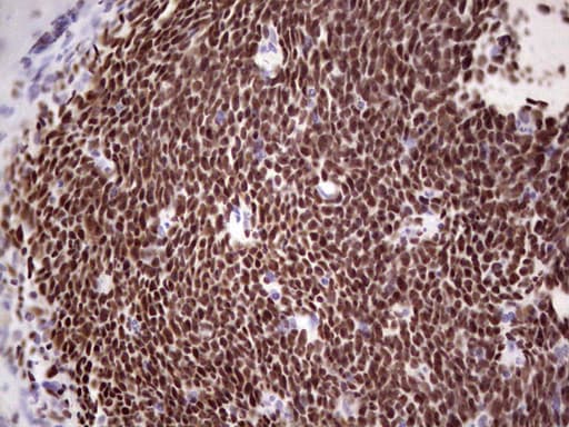 Monoclonal Mouse anti-Human IKZF3 / AIOLOS Antibody (clone OTI4H7, Carrier-free, aa1-301, IHC, WB)