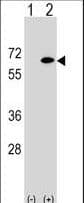Polyclonal Rabbit anti-Human EYA2 Antibody (aa216-244, WB)