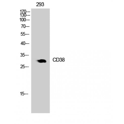 Polyclonal Rabbit anti-Human CD38 Antibody (211-260 aa, Internal, IHC, WB)