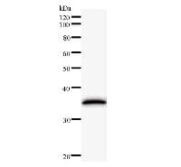 Monoclonal Mouse anti-Human CSA / ERCC8 Antibody (clone 235C3a, WB)