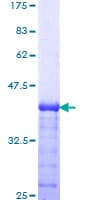 Human ARSA / Arylsulfatase A Protein (Recombinant GST, N-terminus)