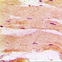 Polyclonal Rabbit anti-Human MBNL1 / MBNL Antibody (IHC, WB)