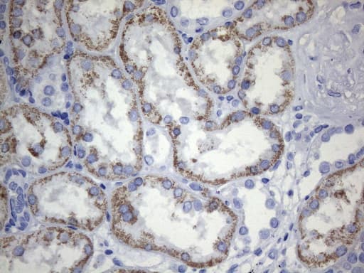 Monoclonal Mouse anti-Human TEM1 / CD248 Antibody (clone OTI1H6, aa20-300, IHC, WB)