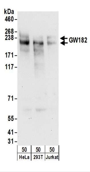 Polyclonal Rabbit anti-Human TNRC6A / GW182 Antibody (aa575-625, WB)