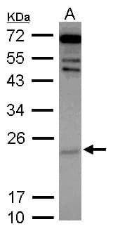Polyclonal Rabbit anti-Human CYGB / Cytoglobin Antibody (IF, WB)