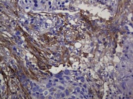 SOAT2 Antibody (clone OTI2D3)