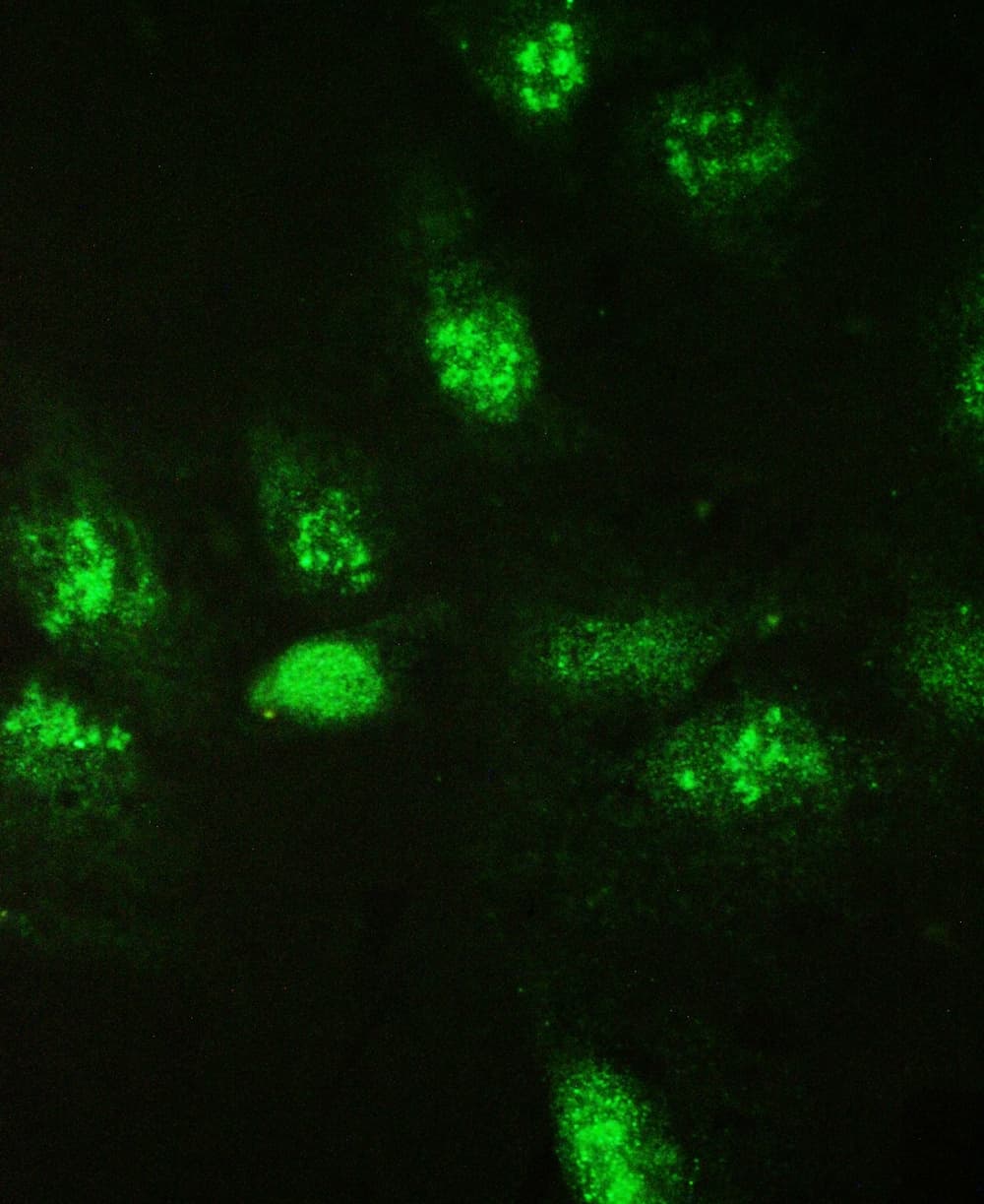 LGALS3 / Galectin 3 Antibody (aa139-250)
