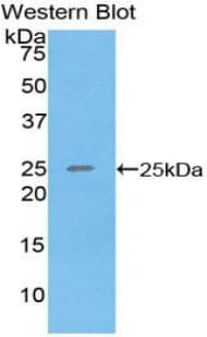 SPRY3 / Sprouty 3 Antibody (aa91-288)