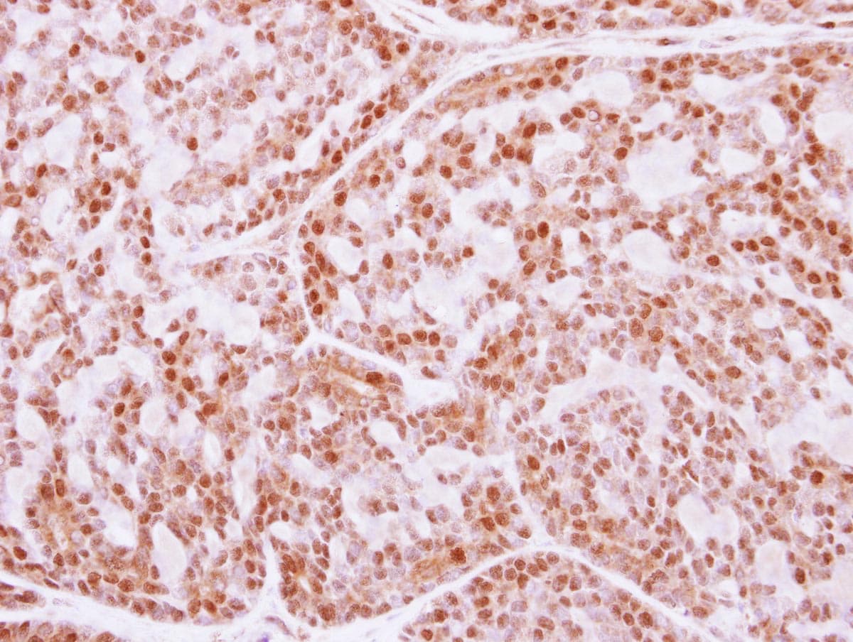 Polyclonal Rabbit anti-Human FANCE Antibody (IHC, WB)